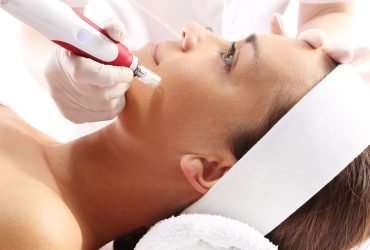 Bella Line – Microneedling